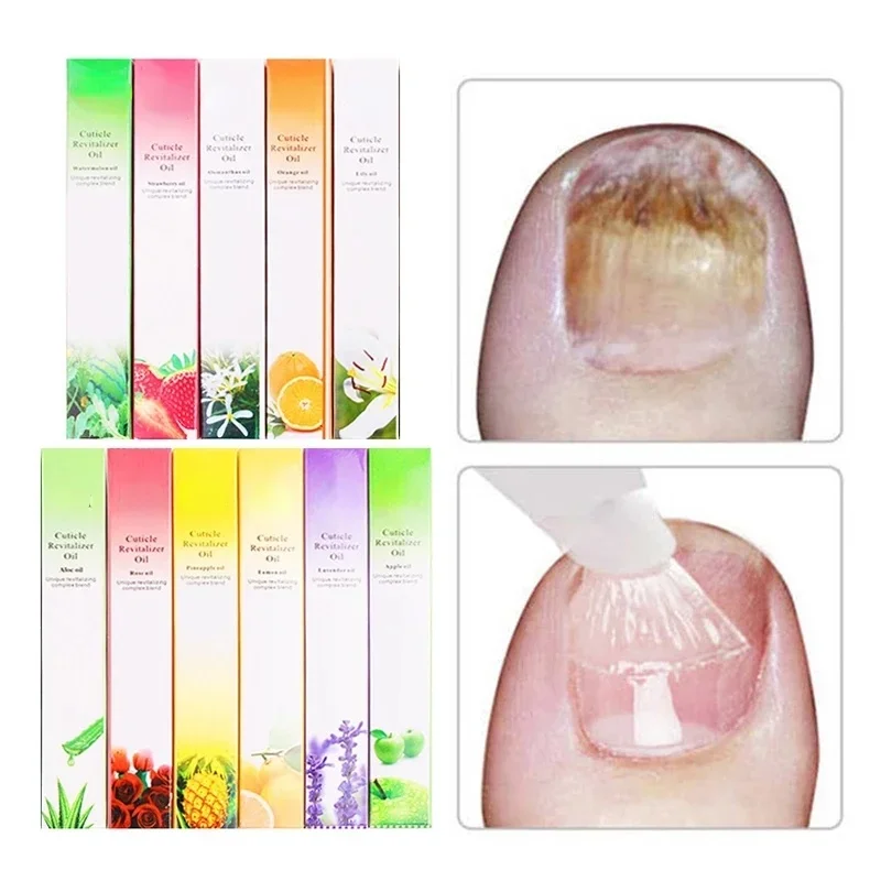 6PCS Nagelhautöl Stift Nagel E – Cuticle Oil Pen Bewertung und Preis