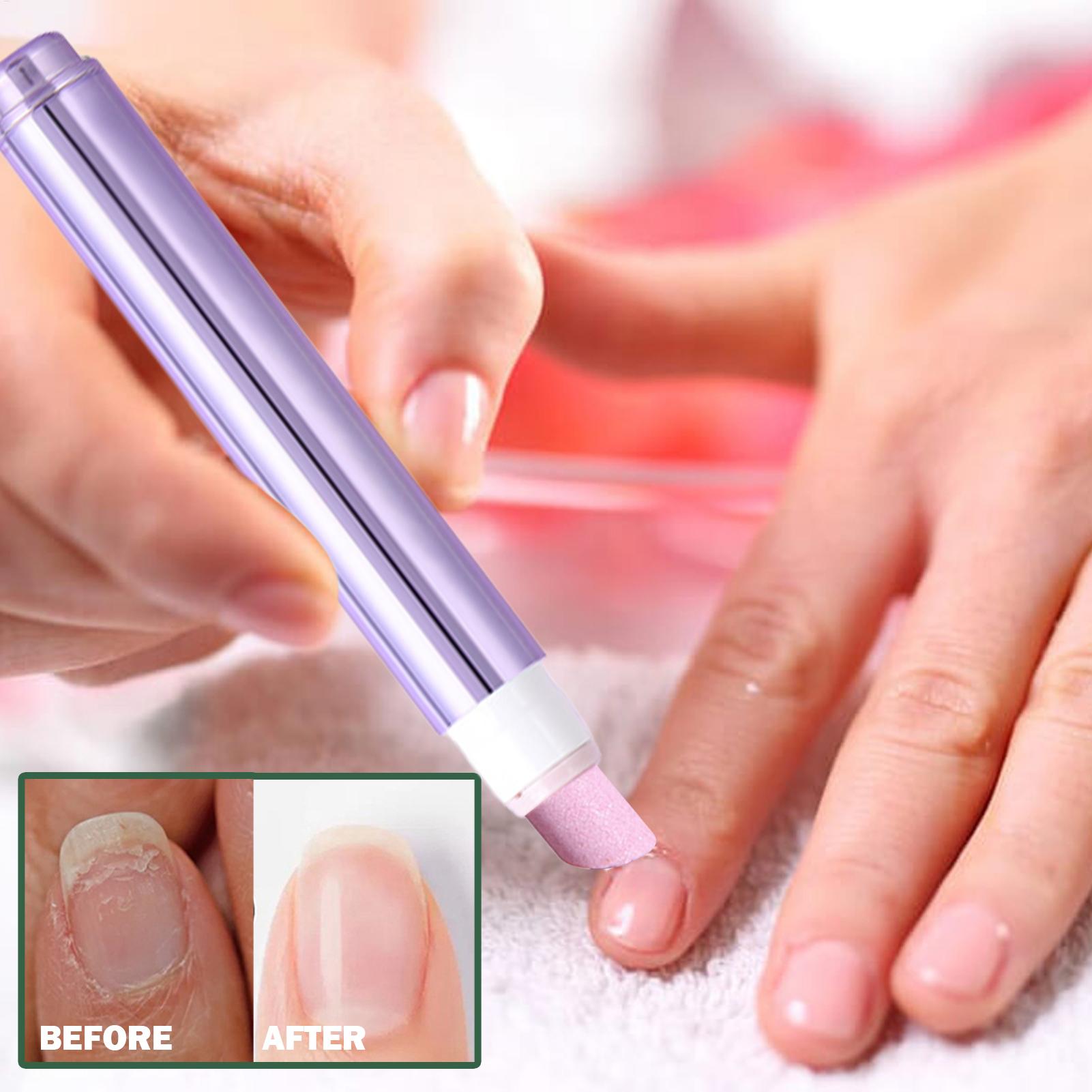 2-in-1-Nagelpflegestift mit Ke – Cuticle Oil Pen Bewertung und Preis